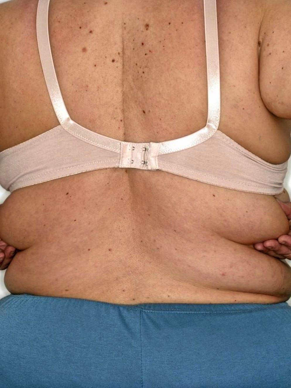 Obese woman
When: 29 Jan 2010
When: 29 Jan 2010
**Only for use by WENN CPS**