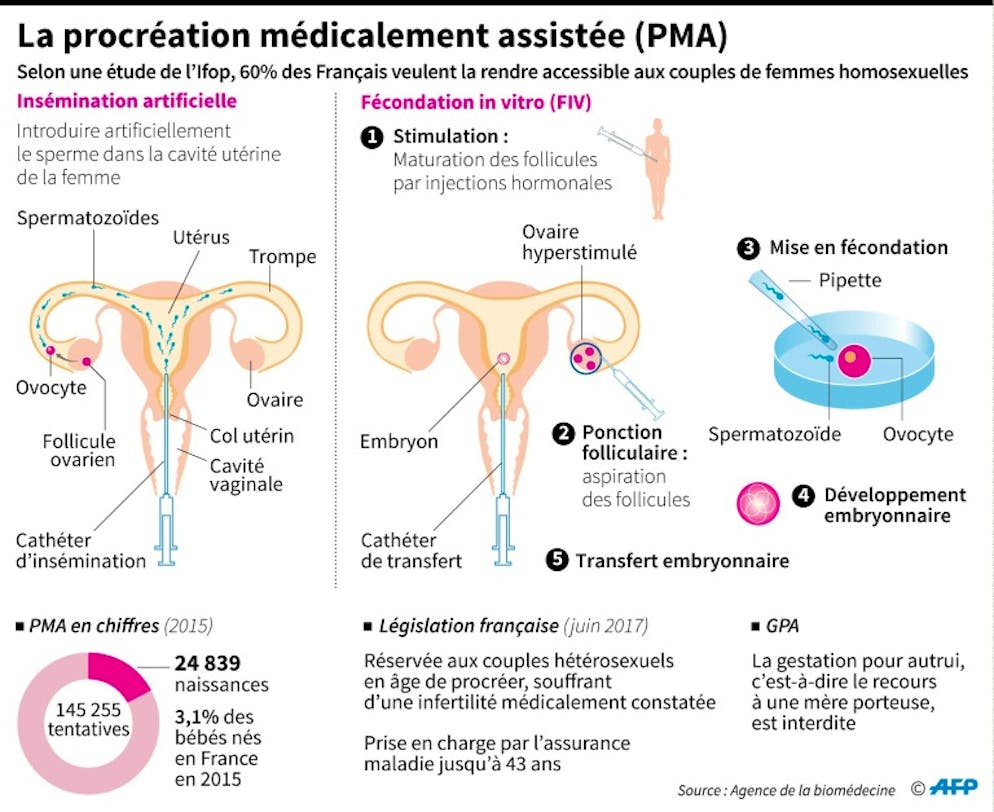 PMA, fin de vie et autres débats brûlants: coup d'envoi des Etats généraux de la bioéthique. La procréation médicalement assistée (PMA)