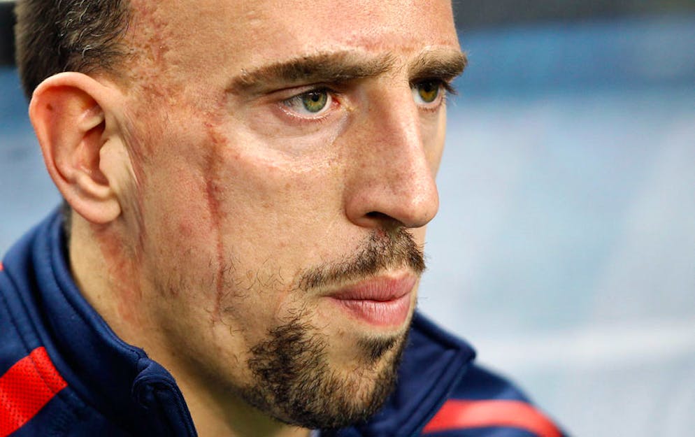 Ces stars se sont converties à l'islam. Franck Ribery fait partie de la liste des stars du ballon rond qui ont embrassé l'Islam.