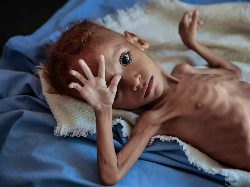 Yemen 85mila Bambini Morti Di Fame In 3 Anni
