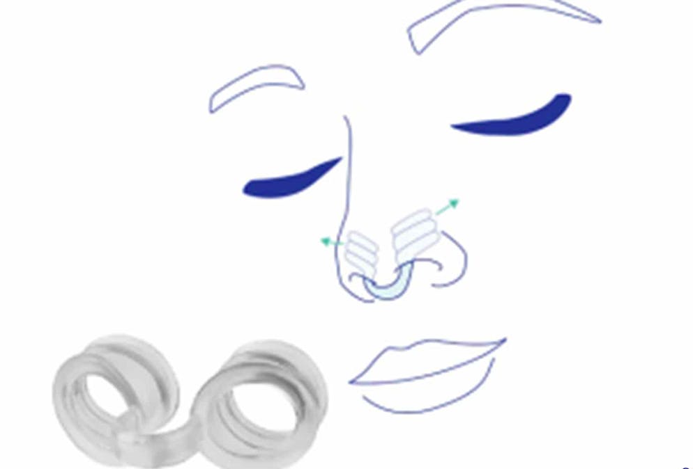 Anti-Schnarch-Hilfen: Ein Sammelsurium an Kuriositäten. Wirksamer soll dieser Nasendilatator oder Nasenspreizer sein. Kaum wird er an die Nase geklammert, verbessert sich die Luftzufuhr, Nasenschnarchen wird verhindert.