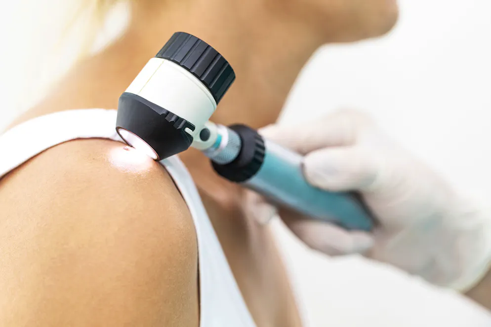 La semaine de dépistage et de sensibilisation des cancers de la peau se tient du 14 au 18 mai