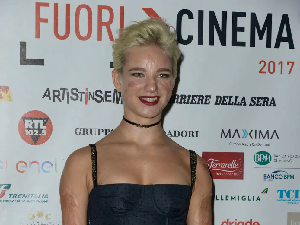 Bebe Vio All Universita Nessuno Sa Chi Sono