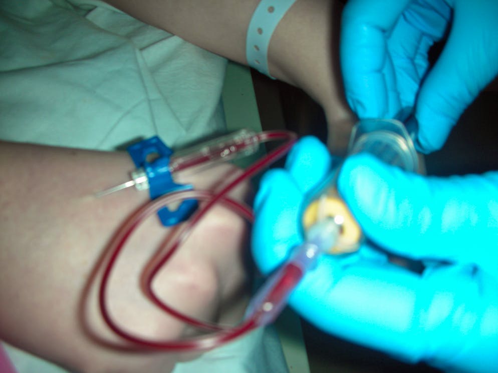 Sie besiegte den Krebs - und «stirbt trotzdem innerlich». Zwischen 2008 und 2009 unterzog sich die junge Frau einer mehrmonatigen Chemo- und Bestrahlungstherapie.