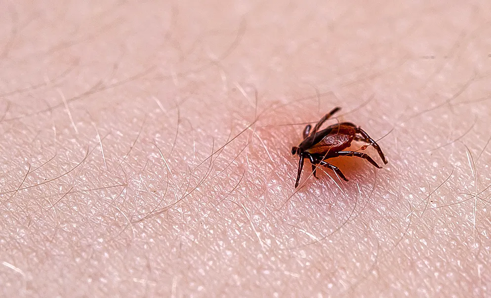 Les symptômes typiques de la maladie sont la fièvre, la fatigue et les maux de tête, ainsi que le plus caractéristique de tous, une éruption cutanée