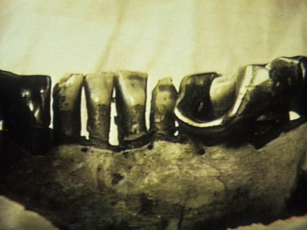 La misteriosa morte di Hitler. I denti inferiori di Adolf Hitler conservati a Mosca sono considerati come una prova autentica della morte del dittatore tedesco. (Archivio)