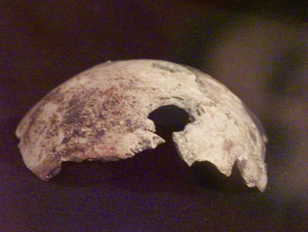 La misteriosa morte di Hitler. Alcuni ricercatori francesi hanno potuto analizzare un frammento di cranio e hanno scoperto un foro sul lato sinistro, probabilmente causato da un proiettile. «Non sapevamo se, per uccidersi, avesse utilizzato una capsula di cianuro o si fosse sparato una pallottola in testa», ha rivelato Philippe Charlier. Secondo ogni probabilità, Hitler ha fatto ricorso ai due metodi.