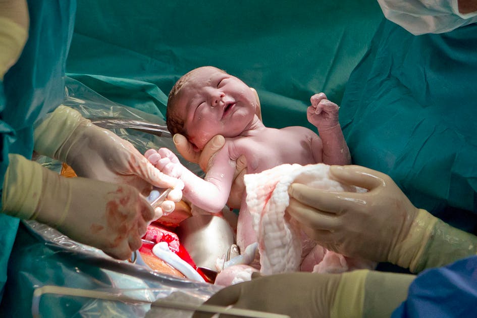 Vaginal Seeding Vaginalsekret soll Immunsystem von Babys stärken blue News