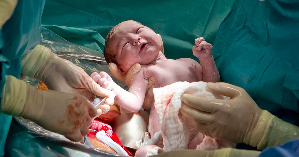 Vaginal Seeding Vaginalsekret soll Immunsystem von Babys stärken blue News Vaginal Seeding Vaginalsekret soll Immunsystem von Babys stärken blue News