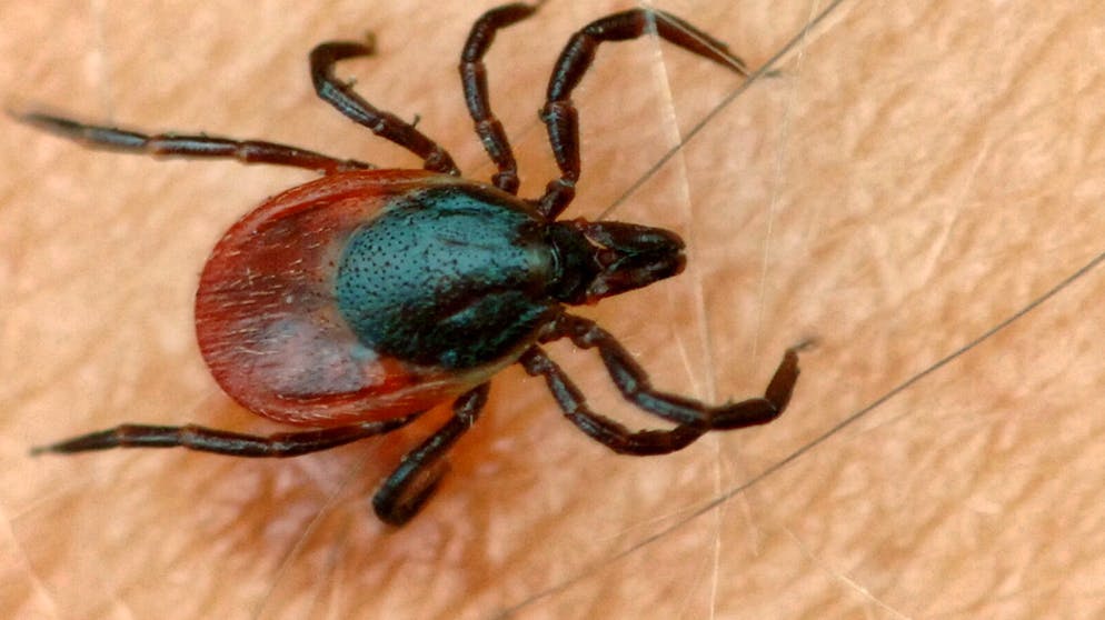 Hitze bietet tropischen Zecken gute Bedingungen: Experten alarmiert. Während die einheimischen Zeckenarten Erreger für Borreliose und Frühsommer-Meningoenzephalitis in sich tragen können, sind es bei der Hyalomma-Zecke Erreger des Zecken-Fleckfiebers oder des Krim-Kongo-Fiebers.