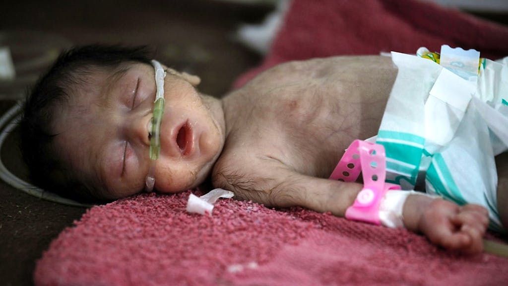 Un Enfant Sur Trois Sous Nutri Ou Trop Gros Un Enfant Sur Trois Sous Nutri Ou Trop Gros