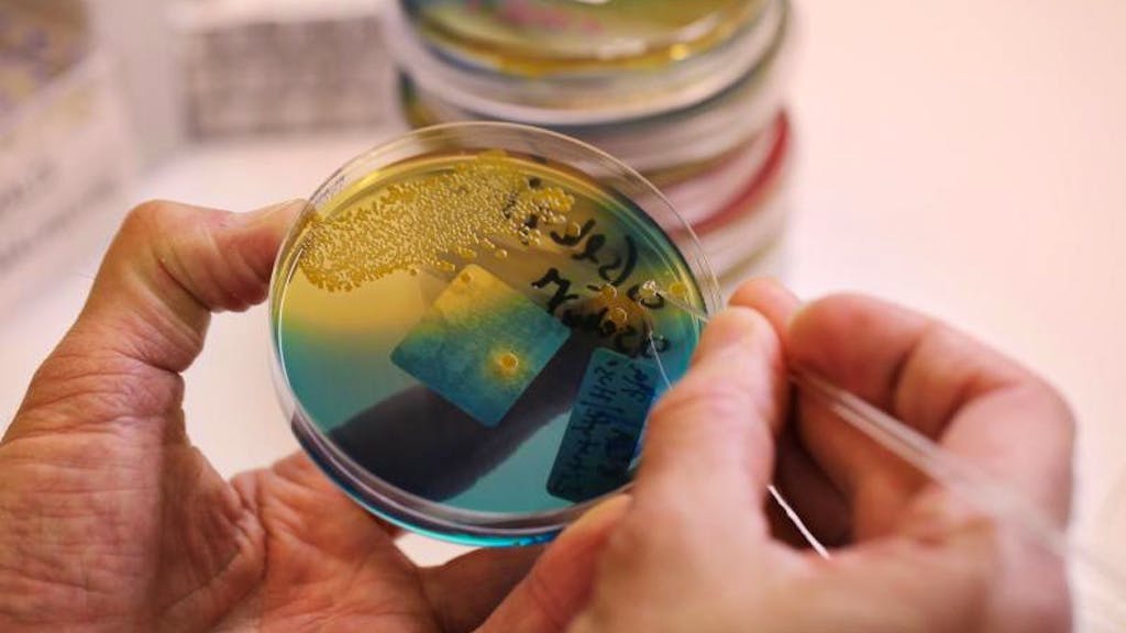 Durch Mücken übertragen. Neu entdeckter Parasit kann tödliche Infektionskrankheit übertragen