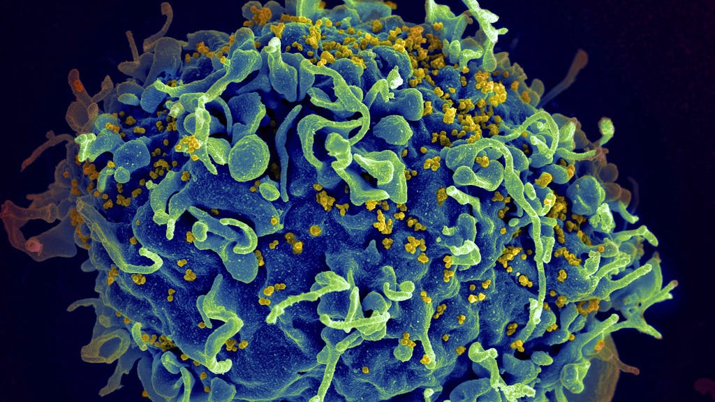 Ende Von Aids In Sicht Therapie Kann Ansteckung Verhindern