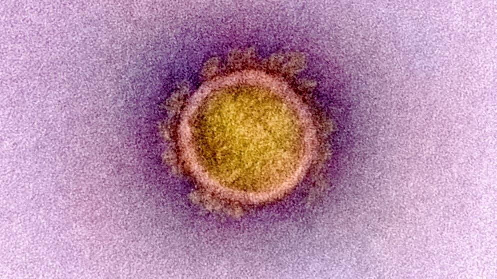Die Coronavirus-Krise: Eine Chronologie. 21. Februar: Italien bestätigt 17 Fälle, womit sich die Gesamtzahl Infizierter auf 20 erhöht. Die Behörden meldet auch den ersten Todesfall, ein 78-jähriger Mann stirbt an Covid-19.