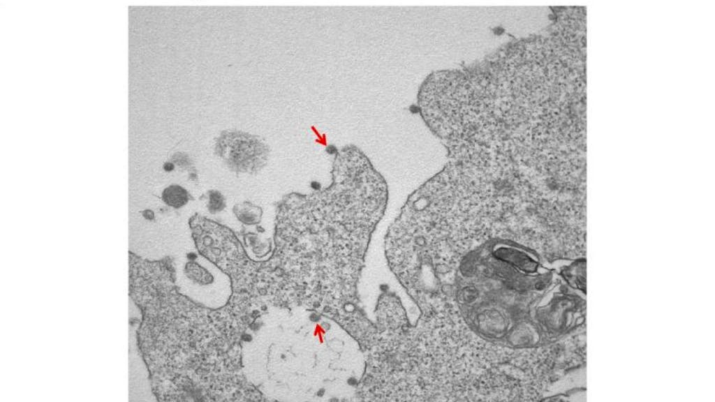 COVID-19. Le prime foto del virus isolato in Lombardia