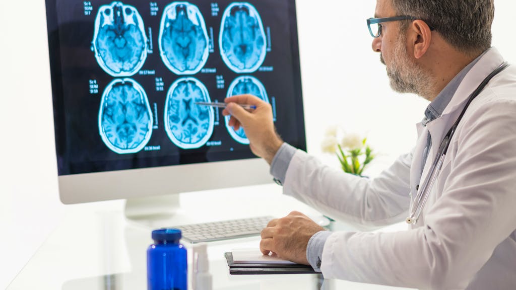 Interview zu COVID-19. Neurologe: «Intensivpatienten zeigen häufiger Zeichen von Verwirrtheit»