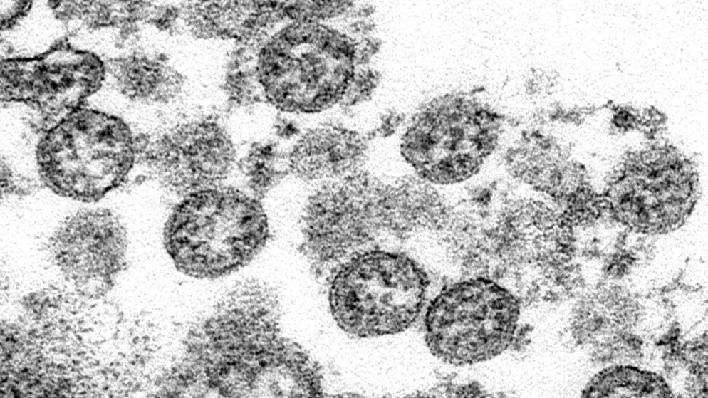 La nuova forma di malattia preoccupa i ricercatori.