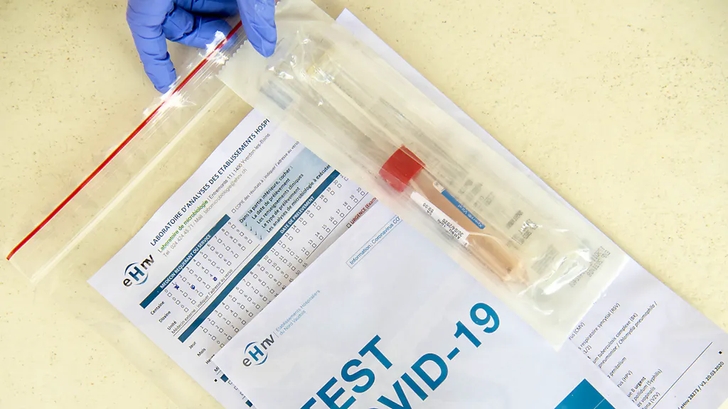 Coronavirus. Trente-six nouveaux cas de coronavirus