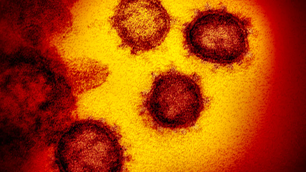 Epidemia. Covid-19: ETH, la seconda ondata potrebbe provocare più morti