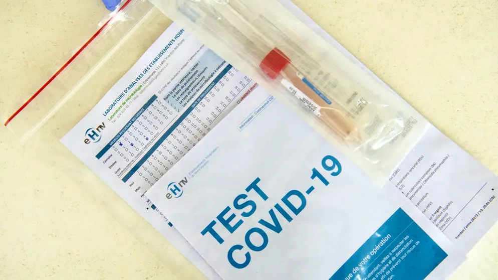 L’affidabilità dei test è oggetto di controversie.