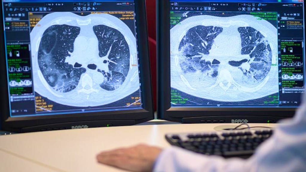 Der Weg zur Genesung. Wie es Patienten nach Covid-19 geht