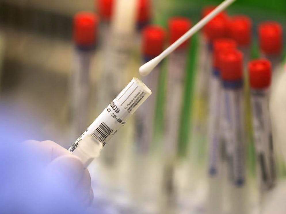 USI e SUPSI hanno unito le proprie competenze multidisciplinari per realizzare uno studio sull'impatto del coronavirus, la sua diffusione e lo sviluppo dell'immunità nella popolazione.