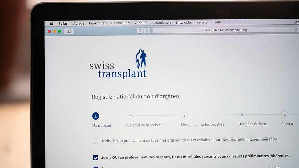 Le iscrizioni devono aumentare, afferma Swisstransplant.