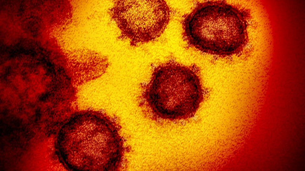 La Spagna, uno dei paesi europei più duramente colpiti dal nuovo coronavirus, ha raggiunto appena il 5% di immuni al Sars-CoV-2. Ciò significa che l'immunità di gregge non è raggiungibile per questo virus.