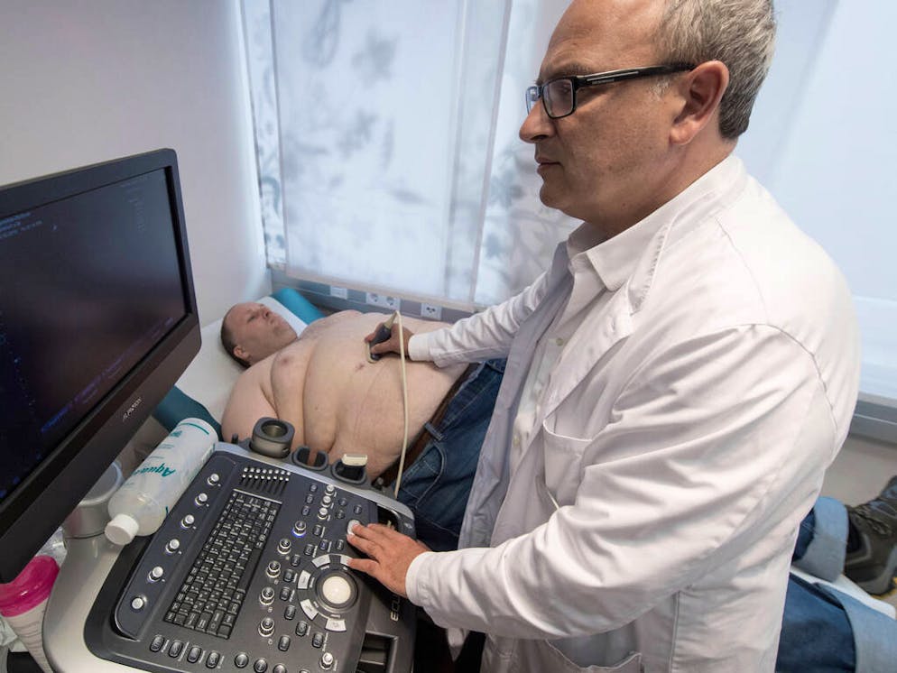 Four weeks after the surgeons formed a gastric sleeve operation, Markus John (L) being examined using an ultra-sound by Head Doctor Plamen Staikov during his first post-op examination at the German Obesity Center at the Sachsenhausen Clinic in Frankfurt, Germany, 04 October 2016. Four weeks after the procedure, the patient weighs 214 kilograms, before the procedure he weighed 237. Photo: Boris Roessler/dpa

Where: Frankfurt/Main, Hesse, Germany
When: 04 Oct 2016
Credit: Boris Roessler/picture-alliance/Cover Images