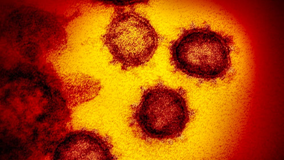 Le nouveau coronavirus a fait au moins 4'689'140 morts dans le monde depuis la fin décembre 2019, selon un bilan de l'AFP (archives).