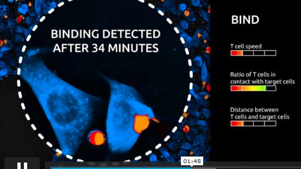 Der neuartige Test Live T Cell Assay lässt Wissenschaftler live teilhaben an der Interaktion zwischen Immun- und Krebszellen. Hier wurde der Moment erfasst, in dem eine Immunzelle an die Krebszelle andockt (Screenshot Nanolive)
