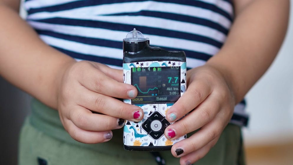 Corona unter Verdacht. Diabetes breitet sich bei Schweizer Kindern rasant aus