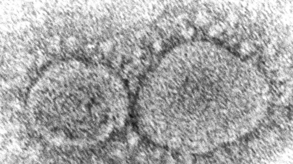 Particelle del virus SARS-CoV-2 fotografate al microscopio elettronico (immagine d'illustrazione)
