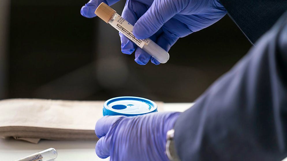 La Svizzera si prepara a essere investita dalla variante Omicron, sempre più rilevata dai test in laboratorio.