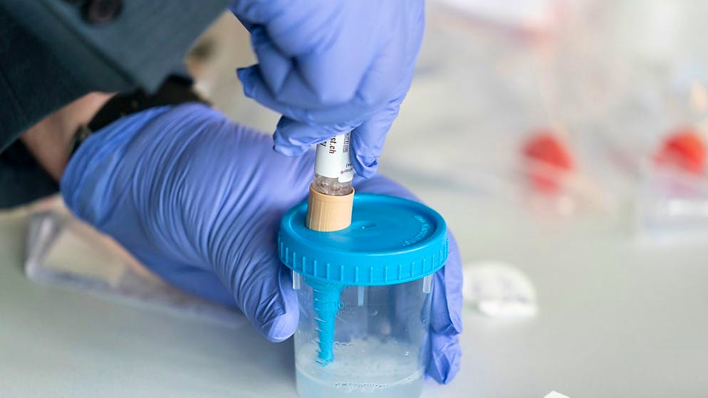 En Suisse, le variant Omicron représente 11,1% des cas de coronavirus séquencés ou examinés dans les laboratoires sur sept jours, avec un délai de deux semaines environ (image symbolique).