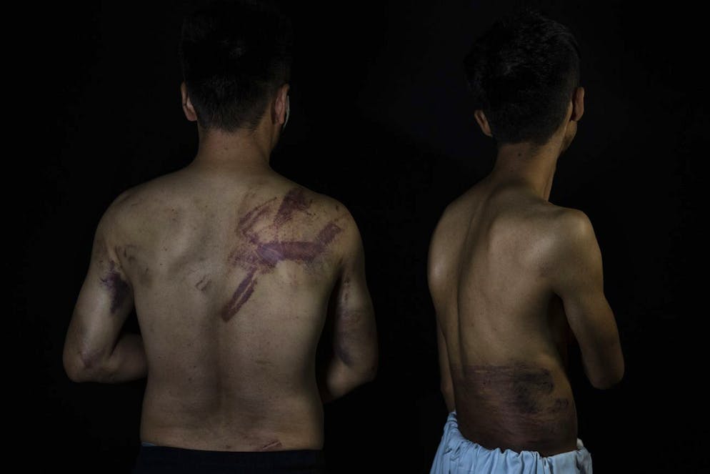 Dans cette photo d'archive du 10 septembre 2021, les journalistes afghans Neamatullah Naqdi, 28 ans, à gauche, et Taqi Daryabi, 22 ans, posent pour un portrait au bureau du quotidien Etilaat Roz, après avoir été arrêtés et battus par les forces talibanes alors qu'ils couvraient un protestation des femmes, à Kaboul, en Afghanistan. Si ces deux-là s'en sont tirés, neuf journalistes ont été tués en Afghanistan cette année.