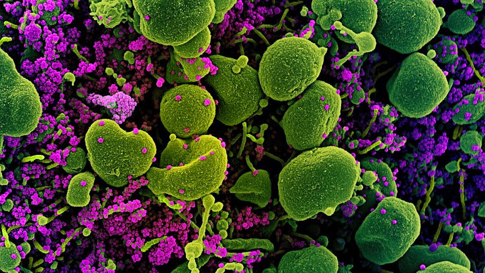 In Svizzera sono finora stati scoperti 6003 casi di infezioni con le varianti mutate del virus SARS-CoV-2, circa il 45% in più rispetto a una settimana fa.