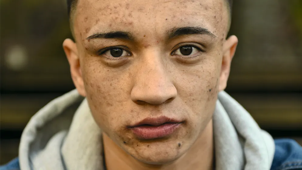 Minderjährige Asylsuchende. Ali, 15: «Man muss lernen, wie man sich selber helfen kann»