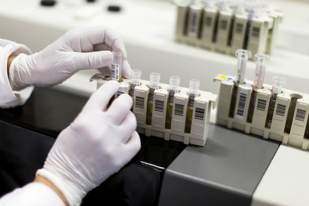 Chargement d'un analyseur avec des échantillons de patients lors de la réalisation d'un test de recherche VIH.