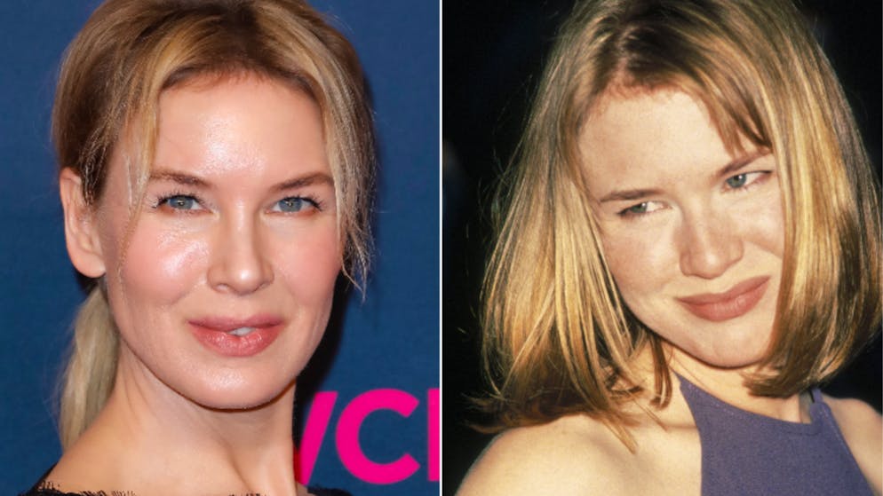 Renée Zellweger hat mehrere Schönheits-OPs hinter sich.