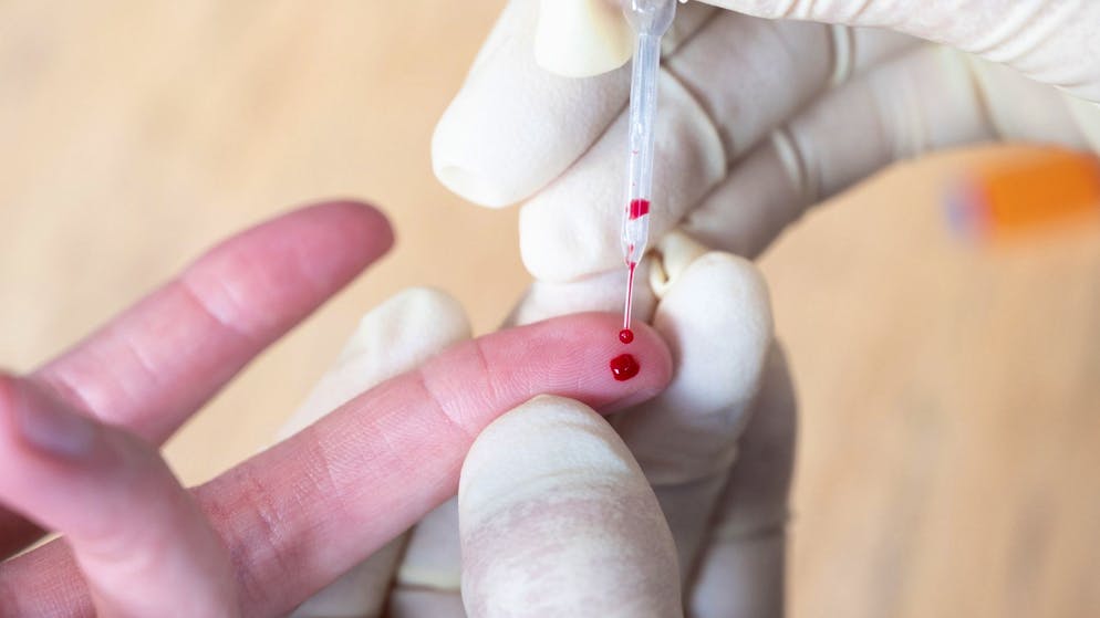 Für einen Corona-Antikörpertest muss Blut abgenommen werden.