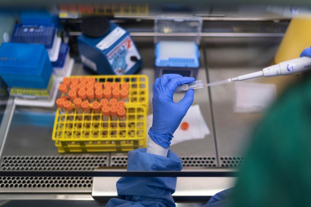 Pipettieren von Corona-Proben durch eine Labor-Mitarbeiterin, am Dienstag, 2. Februar 2021, im Zentrallabor Stadtspital Triemli in Zuerich. (KEYSTONE/Gaetan Bally)