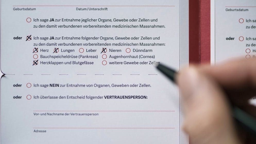 Nur mit einer schriftliche Verfügung oder einer Organspendekarte sollen im Todesfall Organe entnommen werden dürfen.