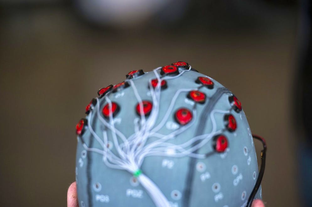 Pour parvenir à percevoir les signaux neuronaux de cette parole bien particulière, l'équipe de l'UNIGE s'est basée sur un panel de treize patients hospitalisés, en collaboration avec deux hôpitaux américains. Elle a collecté des données grâce à des électrodes directement implantées dans leur cerveau, un dispositif déployé à l'origine pour évaluer leur trouble épileptique. (image d'illustration)