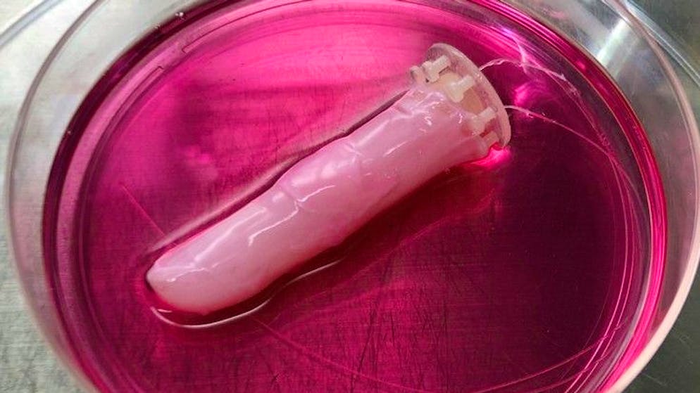 HANDOUT - Caption: In the culture medium a robotic finger covered with human living skin self heals after researchers covered its wound with a collagen sheet; Credit: Shoji Takeuchi Foto: Shoji Takeuchi