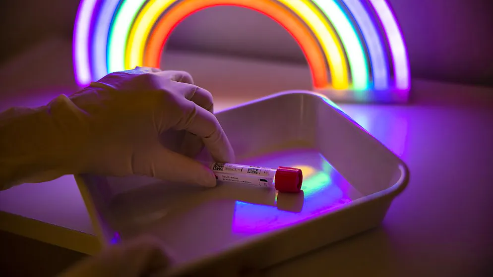 PCR-Abstrich für Chlamydien in Zürich. Anonyme Gratistests sind nun auch in Bern im Gespräch. (Archivbild)