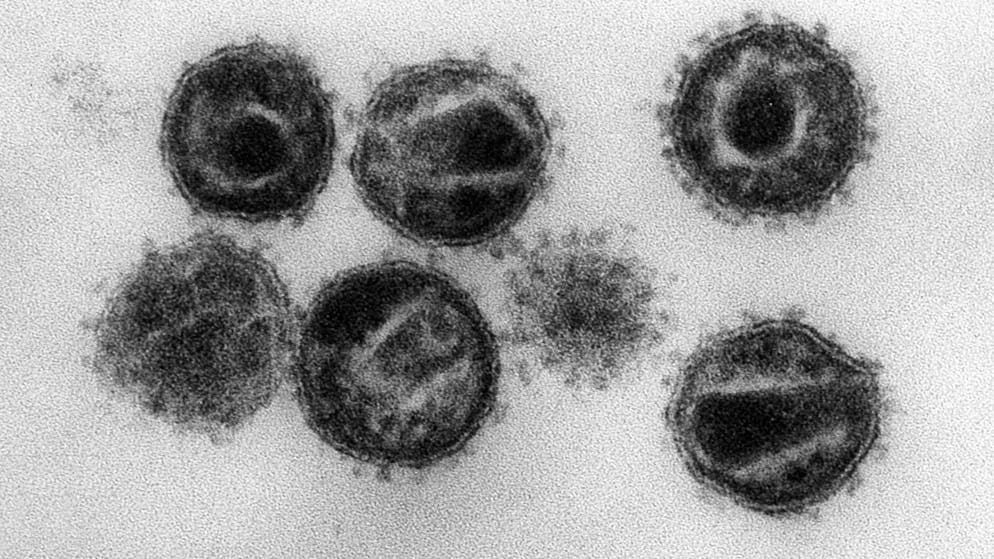 Forscher*innen machen sich Hoffnungen, durch gentherapeutische Ansätze einer Krebsheilung näher zu kommen. (Symbolbild)