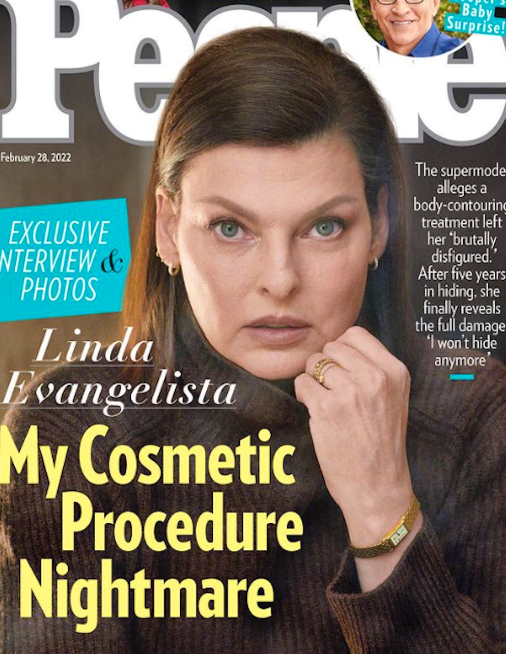 «Das Cool-Sculpting-Verfahren vergrösserte meine Fettzellen, statt sie zu verkleinern und hat mich dauerhaft deformiert»: Linda Evangelista, hier auf dem «People»-Cover, über ihre Schönheits-OP.
