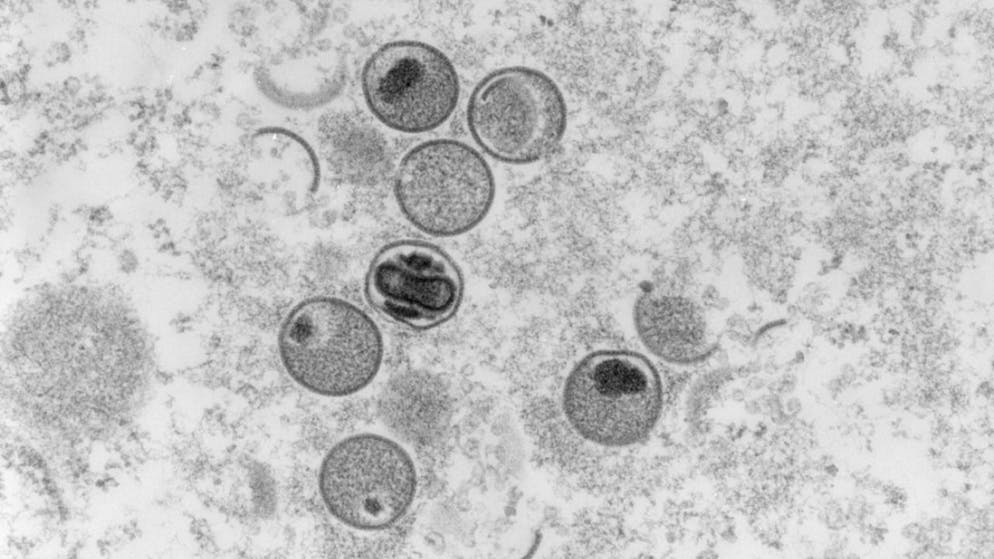 Il virus del vaiolo delle scimmie