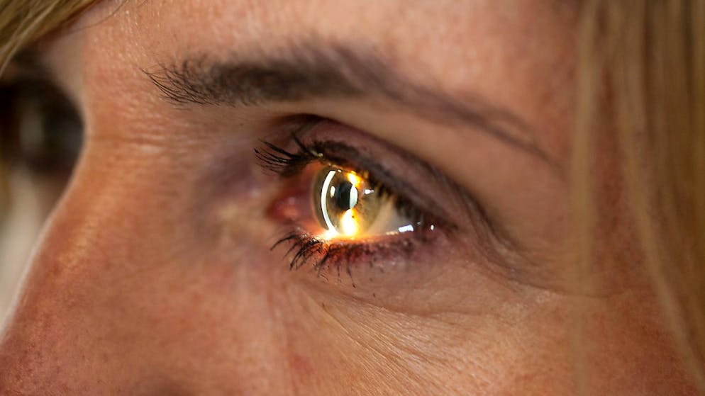 Le Vabysmo de Roche est désormais homologué dans l'UE pour les deux affections rétiniennes qui sont les principales causes de perte de vision dans le monde. (archives)